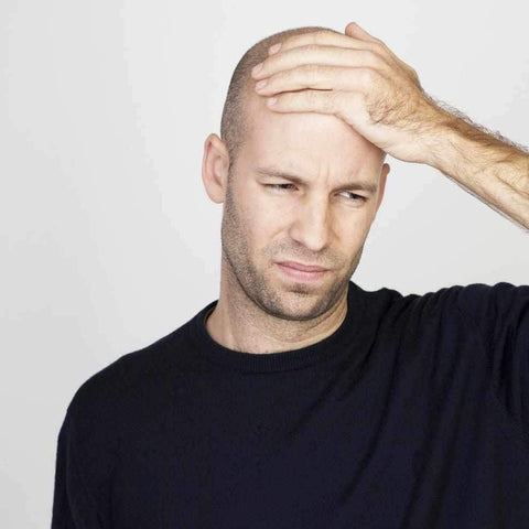 Can Absolute Collagen prevent Balding?