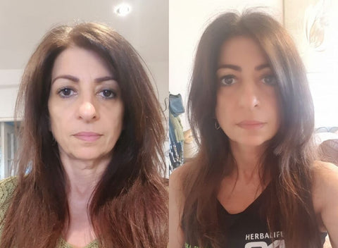 Absolute Collagen summer reviews. Before and after of #Absoluter with great improvement to neck, face, hair and chin.