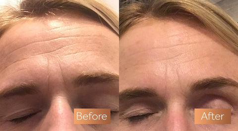 does Absolute Collagen work?